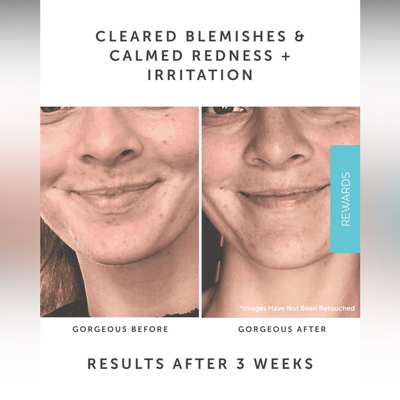 New Earth Harbor SAMPHIRE Biotic Perfecting Serum 1oz - Picture 5 of 7